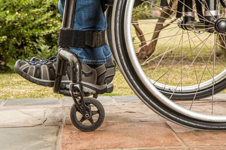 Accident de la route non responsable ayant pour conséquence une blessure importante de la cheville